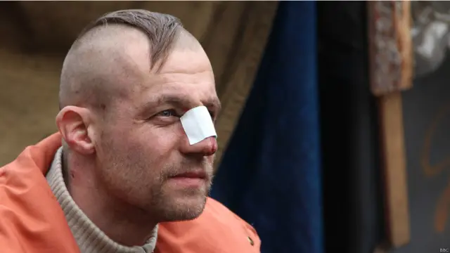 Рани козака Гаврилюка, з якого знущалися силовики, були ще свіжими. 