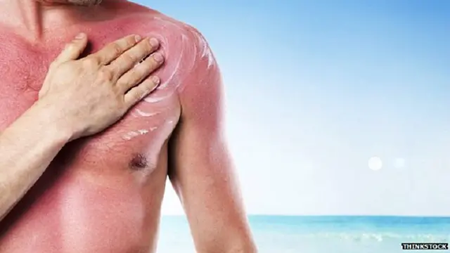 त्वचा टैनिंग