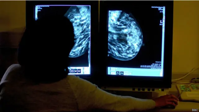 Мамограмма