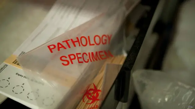 शवों का पोस्टमार्टम