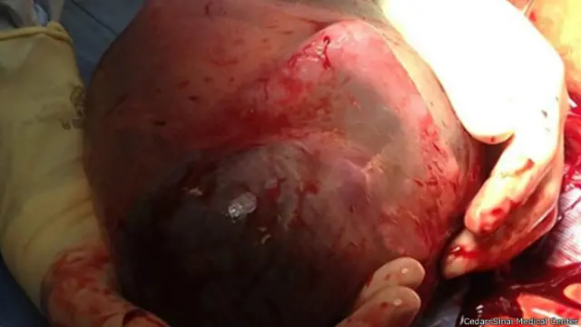 Плодная оболочка