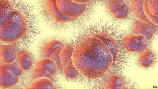 تقرير منظمة الصحة العالمية أظهر أن 34 دولة فقط لديها "خطة وطنية" لمواجهة المستويات المتزايدة لمقاومة المضادات الحيوية