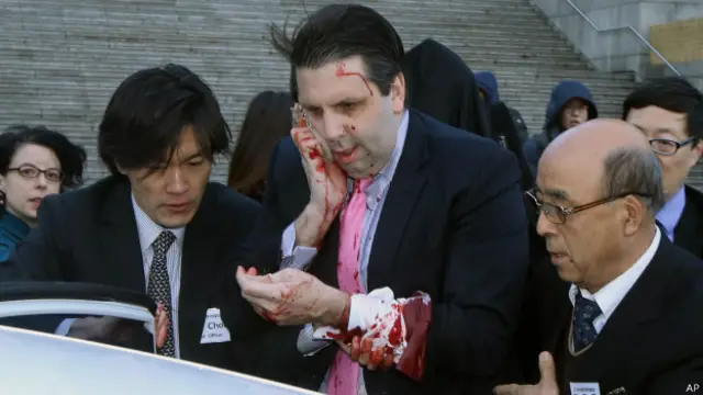 美国驻韩国大使李柏特星期四（3月5日）上午在首尔遭到不明身份人士的突然袭击并受伤。