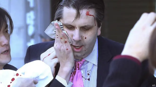 سفیر پر سر او ښي لاس لګېدلی.