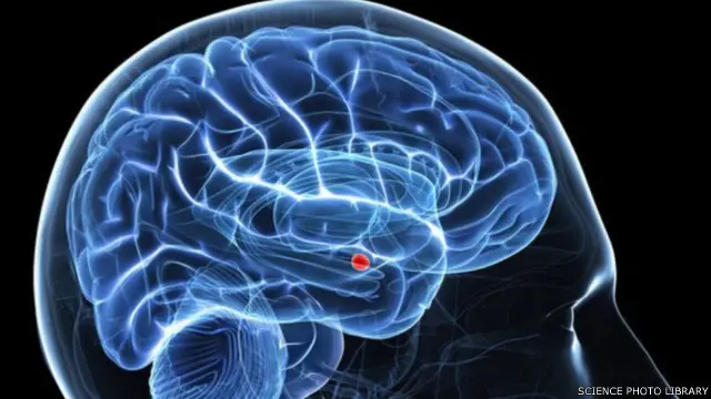 مرضى التوحد يعانون من تراجع نشاط اللوزة العصبية (باللون الأحمر) في الدماغ