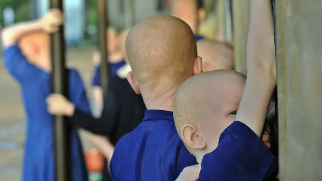 Bagian tubuh orang albino dipercaya bisa membawa keberuntungan.