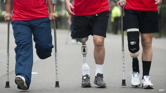 Prótesis de víctimas de minas