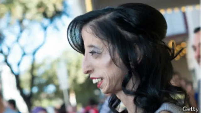 Ahora tiene 26 años, mide metro y medio y pesa 27 kilos.