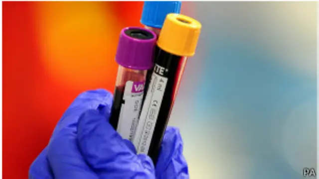 रक्त की तुलना