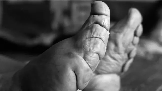 چین میں 1912 میں خواتین کے پاؤں کو باندھنے کی رسم پر پابندی عائد کی گئی تھی