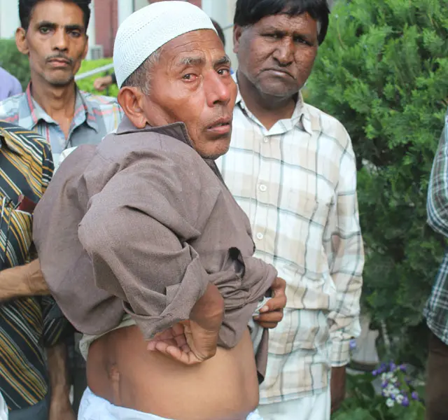 محمد عثمان اپنی پیٹھ پر گولی کا زخم دکھاتے ہوئے