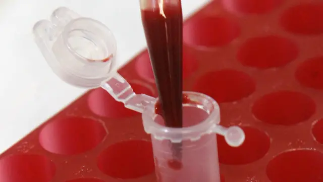 аналіз крові