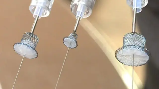 یہ آلہ ٹوپی کی طرح لگتا ہے اور اسے مریض کے دل میں سوراخ کو بند کرنے کے لیے استعمال کیا جاتا ہے