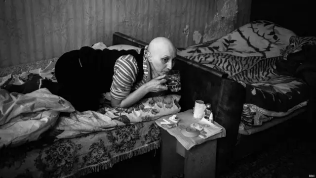 Müalicələrin bir faydası olmayıb və iki ilə yaxındır ki, Sara bu ağır xəstəliklə yaşayır. 