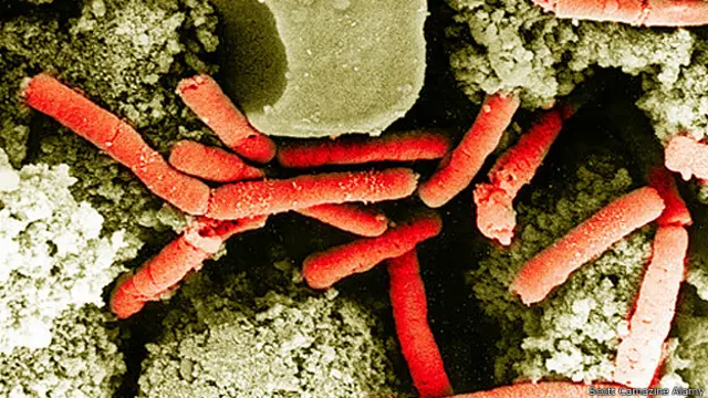 Бактерия сибирской язвы