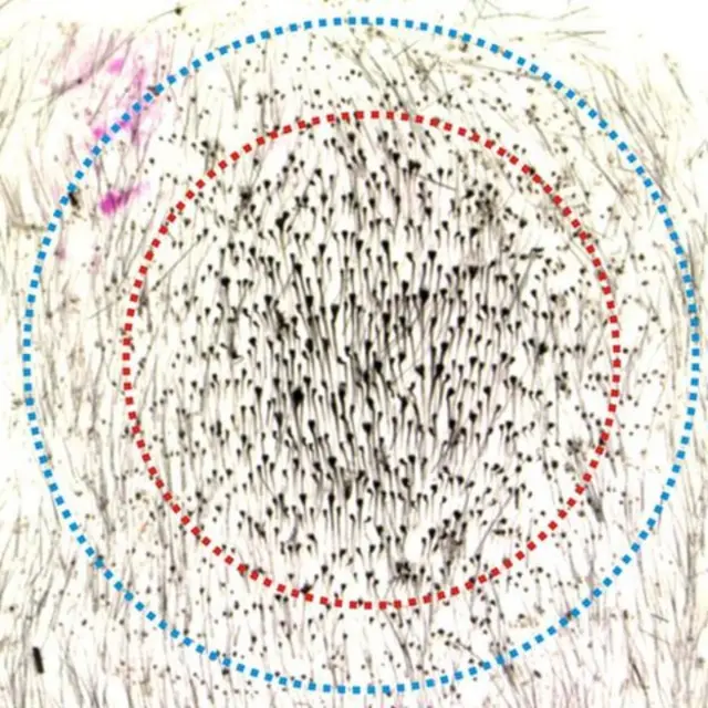 Участок исследуемой кожи