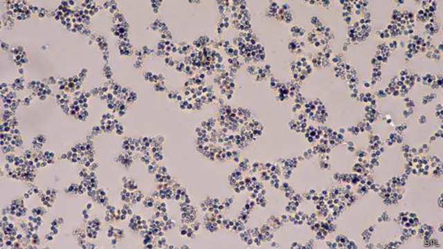 Cientista identificou aumento nas leveduras do intestino após uso prolongado de antibióticos