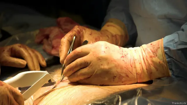 سزارین مثل هر عمل جراحی دیگری دارای عوارضی مثل عفونت زخم، عفون لگنی، عفونت ریوی، عفونت مجاری ادرار، آمبولی ریه، ترومبوز وریدی و عوارض بیهوشی بوده و خطر مرگ یا عوارض برای مادر و کودک در آن بیشتر از زایمان طبیعی است