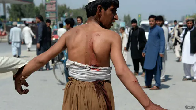 පසුගියදා ඇෆ්ගනිස්තානයේ ජලාබාද් නගරයට එල්ල වූ මරාගෙන මැරෙන බෝම්බ ප්රහාරයකින් තුවාල ලැබූ සාමාන්ය වැසියෙක්