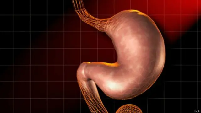 पेट की तस्वीर