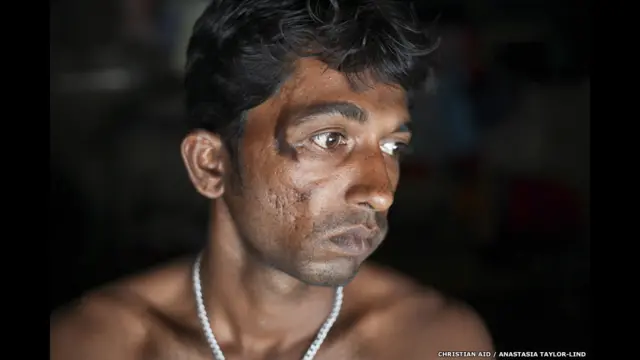 अनाथ सील, झड़खाली, बासंती द्वीप, पश्चिम बंगाल