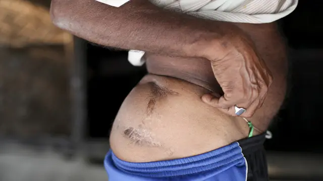 رنجیت بسواس چیتے کے حملے میں زخمی ہو گئے