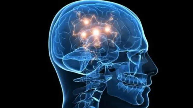 Cilmi baaris lagu sameeyay maskaxda bini'aadamka