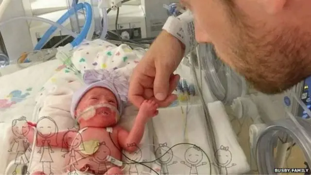 bayi kembar lima texas