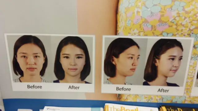 愛美之心人皆有之,有些顧客的確通過整容取得了滿意效果