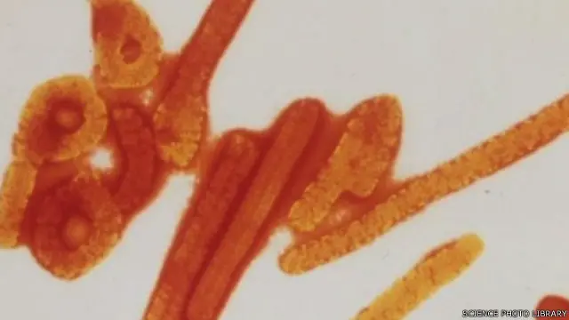 سنہ 1976 میں ایبولا وائرس کی دریافت کے بعد وائرس کا یہ مہلک ترین حملہ ہے