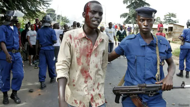 Пострадавший в ходе протестов оппозиции в Бурунди