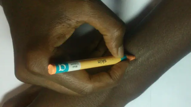 स्किन की चिप्पी वाला क्रेयोन