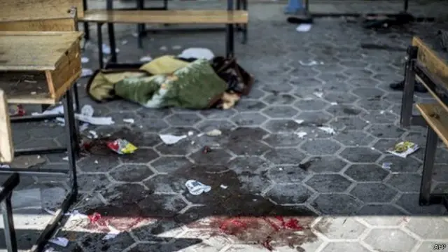 227 فلسطينيا أصيبوا في قصف إسرائيل للملاجئ في غزة