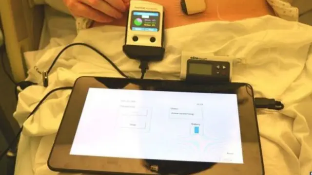 البنكرياي الصناعي