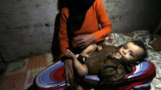 اضطرت العديد من الأسر إلى اتخاذ ملاجئ لها تحت الأرض هربا من الصراع