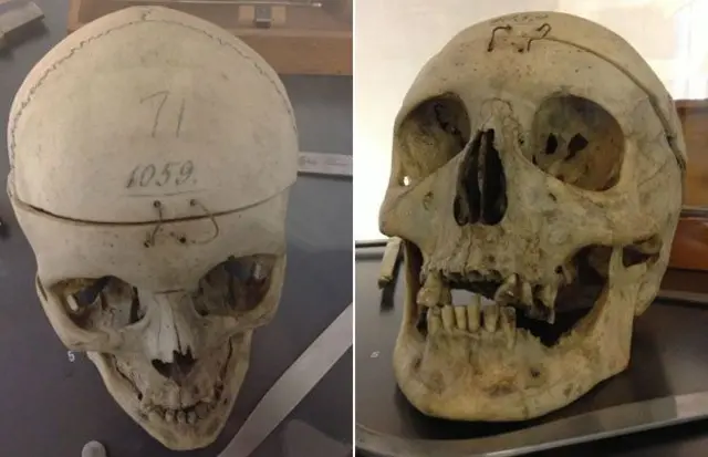 هغه ککرۍ چې ډاکټر لمبروسو ورباندې څېړنې کولې