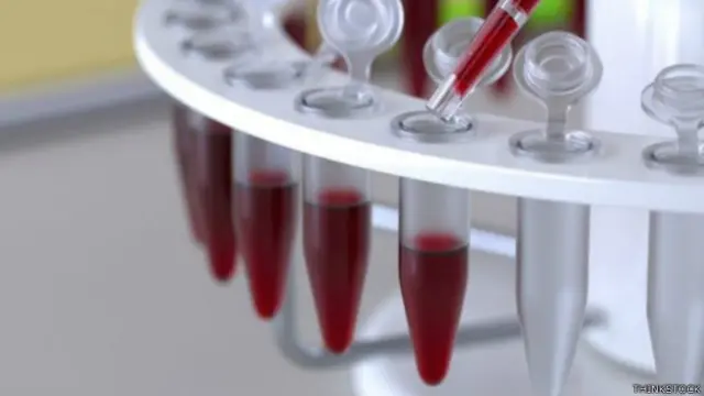प्रयोगशाला में ख़ून का प्रयोग