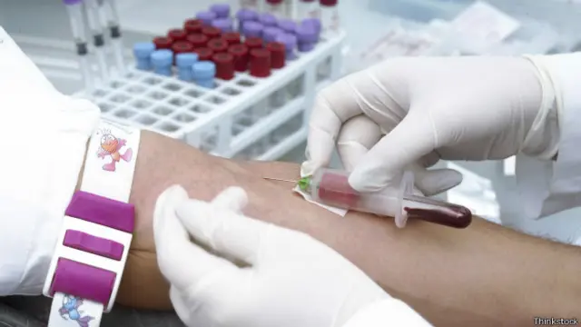 اندازه‌گیری CA۱۲۵ با یک آزمایش خون ساده میسر است