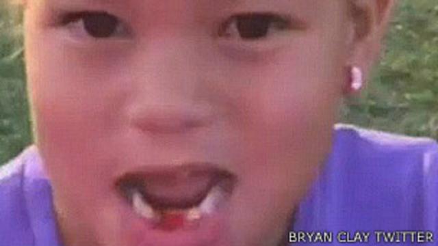 La hija del atleta olímpico Bryan Clay muestra el hueco donde estaba su diente