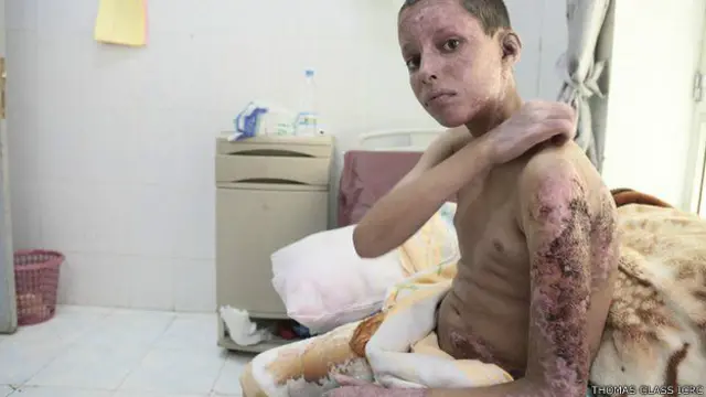 yemen, destrucción, hutíes