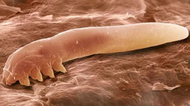 Demodex folliculorum