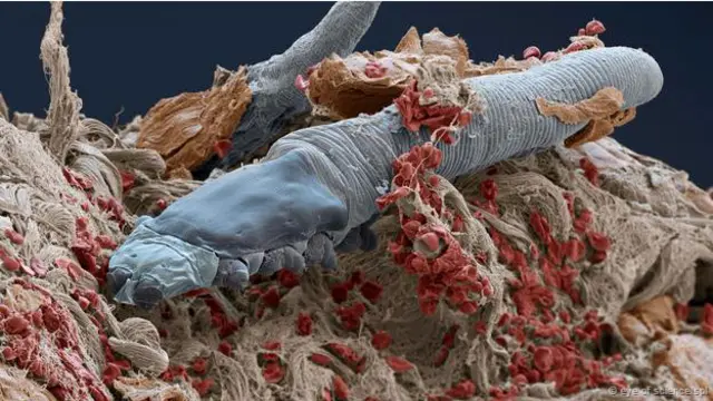 Los ácaros microscópicos que viven en nuestra cara - BBC News Mundo