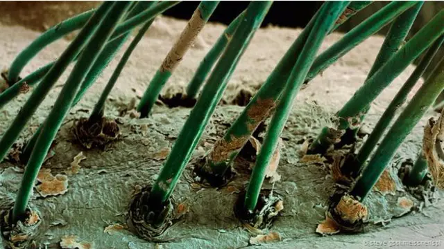 Acaros en folículos pilosos