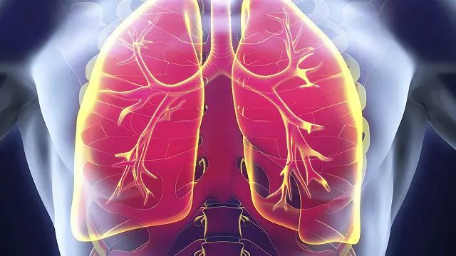 ٹی بی سے نئے متاثر ہونے والے مریضوں کا تعلق چین، بھارت، انڈونیشیا، نائیجریا اور پاکستان سے ہے