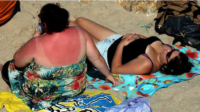 Обгоріла пляжниця на узбережжі у Корнуолі