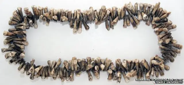 Parker apostaba por la odontología sin dolor, armado con una jeringa de cocaína aguada.