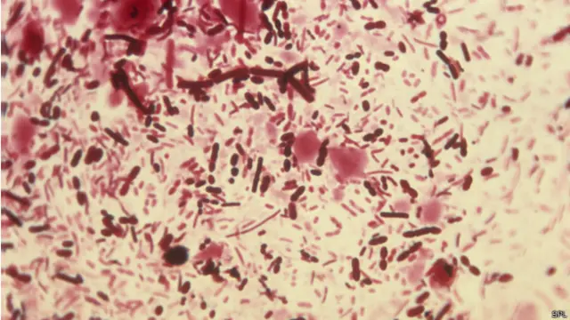 மனித உடலில் உணவின் கழிவு வெளியேறும் குதப்பகுதி பாக்டீரியாக்கள் தான் நோய் எதிர்ப்பு சக்திக்கு அத்தியாவசியமானவை