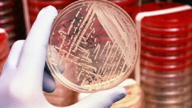 أحد المضادات الجديدة أثبت فاعليته في مواجهة أمراض السل وبكتيريا المكورات العنقودية