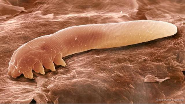 'Demodex follicullorum' é um artrópode, com oito patas e corpo alongado