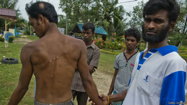 Kondisi mengenaskan yang dialami seorang pengungsi asal Bangladesh.
